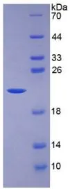 SDS-PAGE analysis of GTX00118-pro Human IL7 protein (active).