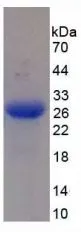 SDS-PAGE analysis of GTX00122-pro Human MASP2 protein.