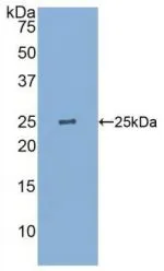WB analysis of GTX00125-pro Human GSTP1 protein.