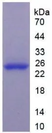 SDS-PAGE analysis of GTX00125-pro Human GSTP1 protein.