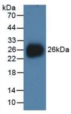WB analysis of GTX00129-pro Human NEU1 protein.