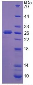 SDS-PAGE analysis of GTX00129-pro Human NEU1 protein.