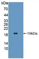 WB analysis of GTX00132-pro Human IL17 Receptor alpha protein. WB analysis of GTX00132-pro Human IL17 Receptor alpha protein.