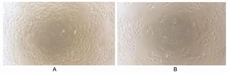 Cell proliferation effect of GTX00138-pro Human IL24 protein (active). Cell viability was measured by Cell Counting Kit-8 (CCK-8). (A) Unstimulated ECV-304 cells cultured in serum-free RPMI-1640 for 48hrs. (B) ECV-304 cells cultured in RPMI-1640, stimulated with 0.1 ng/ml IL24 for 48hrs.