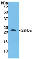 WB analysis of GTX00139-pro Human ARMET protein (active). WB analysis of GTX00139-pro Human ARMET protein (active).