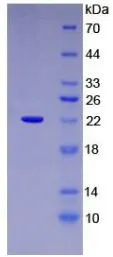 SDS-PAGE analysis of GTX00139-pro Human ARMET protein (active).