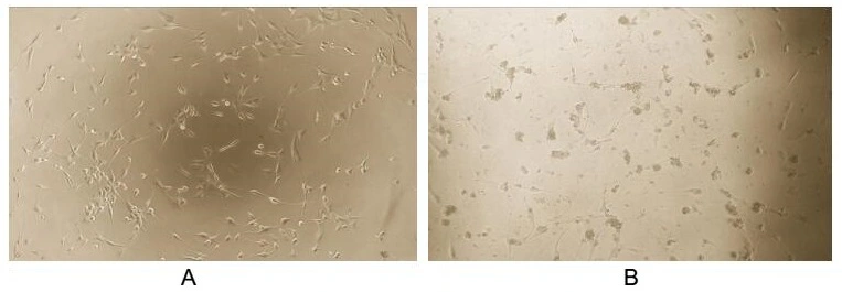 Cell suppression effect of GTX00139-pro Human ARMET protein (active). (A) Unstimulated U87-MG cells cultured in DMEM for 48hrs. (B) U87-MG cells cultured in DMEM, stimulated with 0.01 ng/ml MANF for 48hrs.