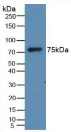 WB analysis of GTX00140-pro Human HRG protein. WB analysis of GTX00140-pro Human HRG protein.