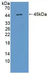 WB analysis of GTX00141-pro Human IL17D protein. WB analysis of GTX00141-pro Human IL17D protein.