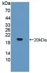 WB analysis of GTX00144-pro Human IL17 Receptor beta protein (active).