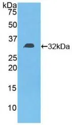 WB analysis of GTX00146-pro Human DGKE protein.