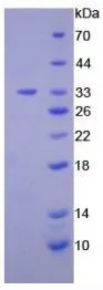 SDS-PAGE analysis of GTX00146-pro Human DGKE protein.