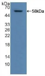 WB analysis of GTX00155-pro Human ALDH1A1 protein.