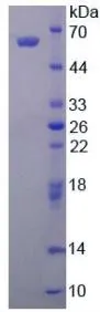 SDS-PAGE analysis of GTX00155-pro Human ALDH1A1 protein.