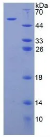 SDS-PAGE analysis of GTX00161-pro Human ARSB protein.