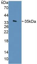 WB analysis of GTX00162-pro Human Arylsulfatase F protein (active).