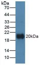 WB analysis of GTX00163-pro Human Vitamin D Receptor protein. WB analysis of GTX00163-pro Human Vitamin D Receptor protein.