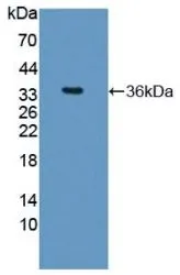 WB analysis of GTX00168-pro Human Arginase 1 protein. WB analysis of GTX00168-pro Human Arginase 1 protein.