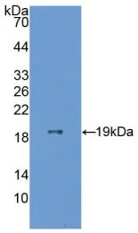 WB analysis of GTX00169-pro Human ESM1 protein (active).