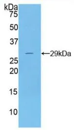 WB analysis of GTX00172-pro Human DNase I protein.