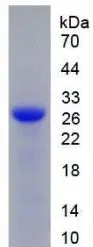 SDS-PAGE analysis of GTX00172-pro Human DNase I protein.