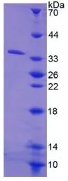 SDS-PAGE analysis of GTX00177-pro Human CES1 protein.
