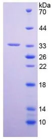 SDS-PAGE analysis of GTX00180-pro Human PAM protein.