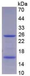SDS-PAGE analysis of GTX00181-pro Human CD66e protein. SDS-PAGE analysis of GTX00181-pro Human CD66e protein.