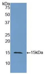 WB analysis of GTX00182-pro Human CD66e protein.