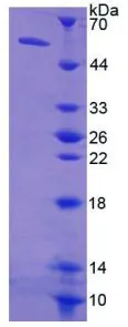SDS-PAGE analysis of GTX00185-pro Human Thymidine Kinase 1 protein.