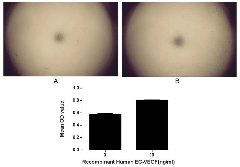 Cell proliferation effect of GTX00186-pro Human EG-VEGF protein (active). Cell viability was measured by Cell Counting Kit-8 (CCK-8). (A) Unstimulated ECV-304 cells cultured in RPMI-1640 for 96hrs. (B) ECV-304 cells cultured in RPMI-1640, stimulated with 10 ng/ml VEGF121 for 96hrs.