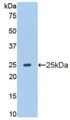WB analysis of GTX00191-pro Human MMP13 protein (active).