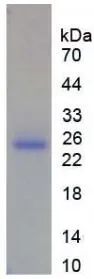 SDS-PAGE analysis of GTX00191-pro Human MMP13 protein (active).