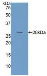 WB analysis of GTX00195-pro Human Galectin 3 protein (active). WB analysis of GTX00195-pro Human Galectin 3 protein (active).