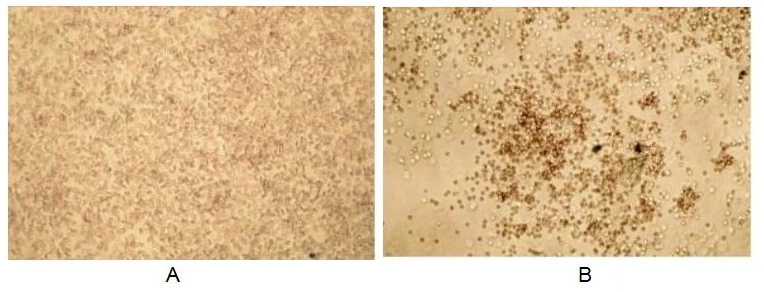 The hemagglutination effect of GTX00195-pro Human Galectin 3 protein (active). (A) 1% rabbit erythrocyte without GAL3. (B) 1% rabbit erythrocyte treated with 1.2 microg/ml GAL3 for 2hrs at room temperature.
