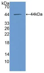 WB analysis of GTX00197-pro Human MIF protein. WB analysis of GTX00197-pro Human MIF protein.