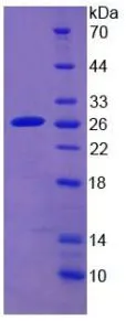 SDS-PAGE analysis of GTX00199-pro Human Cytochrome P450 2D6 protein.