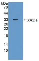 WB analysis of GTX00204-pro Human PDGF beta protein (active). WB analysis of GTX00204-pro Human PDGF beta protein (active).