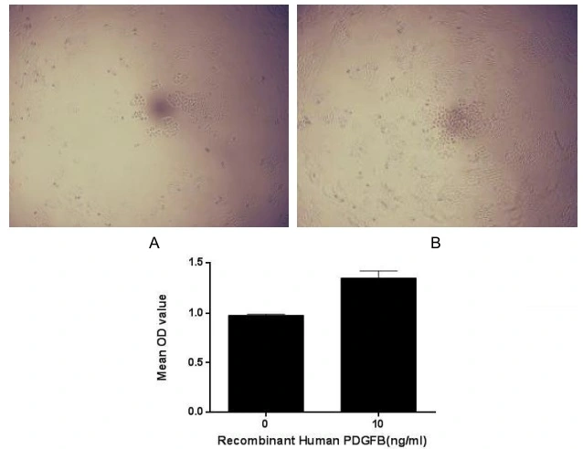 Cell proliferation effect of GTX00204-pro Human PDGF beta protein (active). Cell viability was measured by Cell Counting Kit-8 (CCK-8). (A) Unstimulated MCF-7 cells cultured in DMEM for 96hrs. (B) MCF-7 cells cultured in DMEM, stimulated with 1 ng/ml PDGFB for 96hrs.