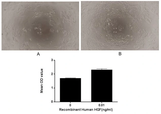 Cell proliferation effect of GTX00205-pro Human HGF protein (active). Cell viability was measured by Cell Counting Kit-8 (CCK-8). (A) Unstimulated HepG2 cells cultured in DMEM for 72hrs. (B) HepG2 cells cultured in DMEM, stimulated with 0.01 ng/ml HGF for 72hrs.