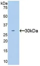 WB analysis of GTX00206-pro Human HGF protein (active). WB analysis of GTX00206-pro Human HGF protein (active).