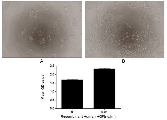 Cell proliferation effect of GTX00206-pro Human HGF protein (active). Cell viability was measured by Cell Counting Kit-8 (CCK-8). (A) Unstimulated HepG2 cells cultured in DMEM for 72hrs. (B) HepG2 cells cultured in DMEM, stimulated with 0.01 ng/ml HGF for 72hrs.