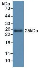 WB analysis of GTX00210-pro Human Gremlin 1 protein (active). WB analysis of GTX00210-pro Human Gremlin 1 protein (active).