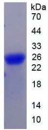 SDS-PAGE analysis of GTX00210-pro Human Gremlin 1 protein (active).