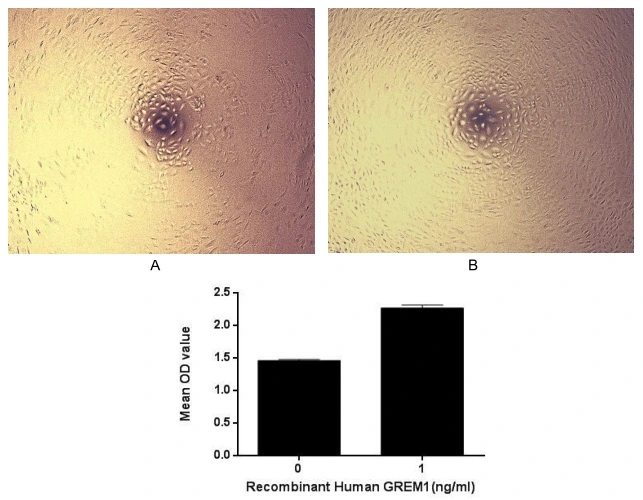 Cell proliferation effect of GTX00210-pro Human Gremlin 1 protein (active). Cell viability was measured by Cell Counting Kit-8 (CCK-8). (A) Unstimulated A549 cells cultured in DMEM for 96hrs. (B) A549 cells cultured in DMEM, stimulated with 1 ng/ml GREM1 for 96hrs.