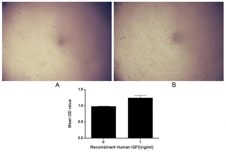 Cell proliferation effect of GTX00213-pro Human IGF2 protein (active). Cell viability was measured by Cell Counting Kit-8 (CCK-8). (A) Unstimulated MCF-7 cells cultured in DMEM for 96hrs. (B) MCF-7 cells cultured in DMEM, stimulated with 1 ng/ml IGF2 for 96hrs.