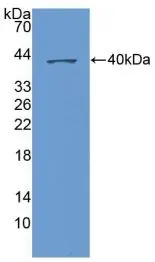WB analysis of GTX00215-pro Human CXCL1 / GRO alpha protein (active). WB analysis of GTX00215-pro Human CXCL1 / GRO alpha protein (active).