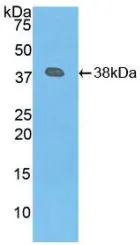 WB analysis of GTX00216-pro Human Plasminogen protein. WB analysis of GTX00216-pro Human Plasminogen protein.