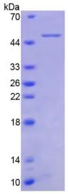 SDS-PAGE analysis of GTX00235-pro Human TNF Receptor II protein (active).