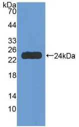 WB analysis of GTX00236-pro Human TNF Receptor I protein. WB analysis of GTX00236-pro Human TNF Receptor I protein.